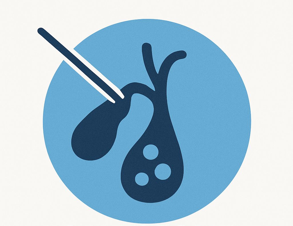 Gall Stone Surgery